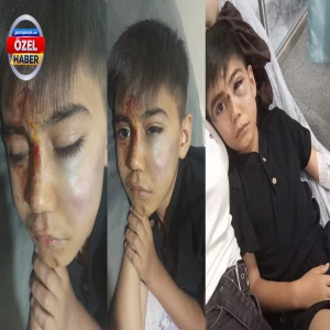 Şanlıurfa'da acılı anne vicdansız sürücüyü arıyor