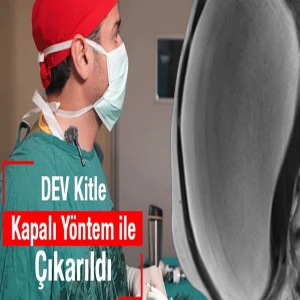 Kasık ve göğüs arası uzanan dev kitle! Şanlıurfa'da ameliyatla yok edildi
