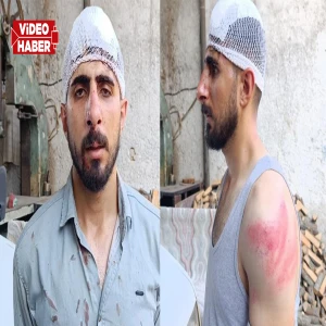 Şanlıurfa’da trafikte yavaş gitti, başına gelmeyen kalmadı!