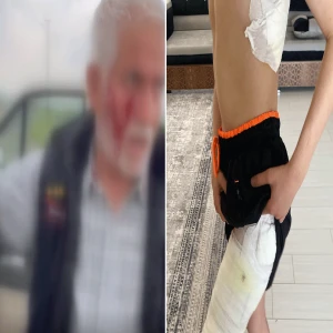 Şanlıurfa’da büyük tehlike geri mi dönüyor? İki günde iki saldırı