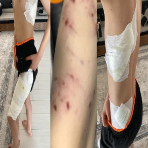Şanlıurfa’da küçük çocuk dehşeti yaşadı! Sokak köpeklerinin saldırısına uğradı