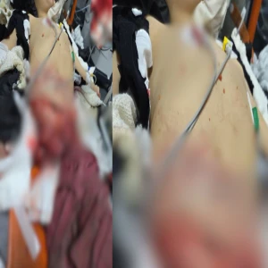 Şanlıurfa'da dualar Ayşe Meryem'e... Öğleden beri ameliyatta