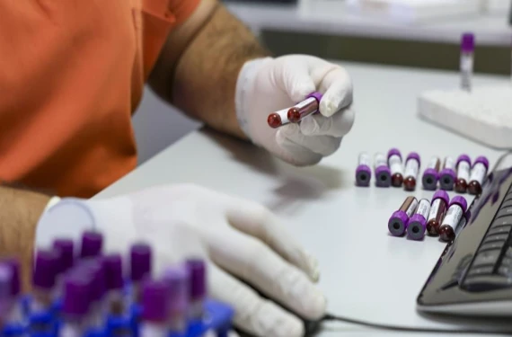 İşte branş dağılımı