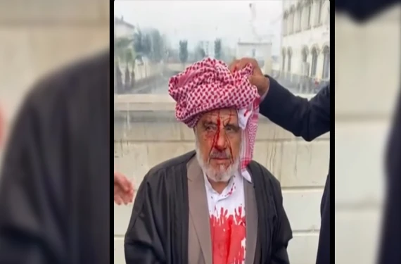 Şanlıurfa'da korkunç olay