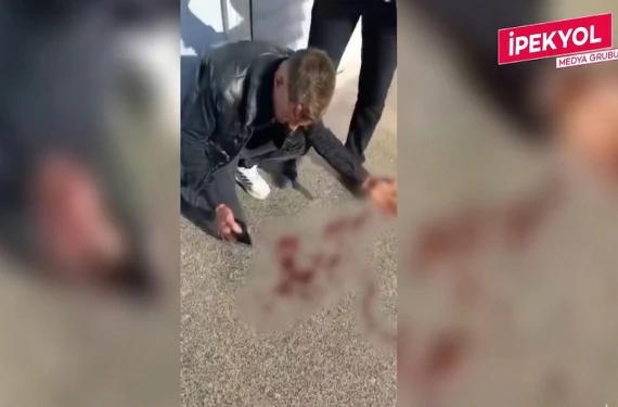 Ölümden döndü...