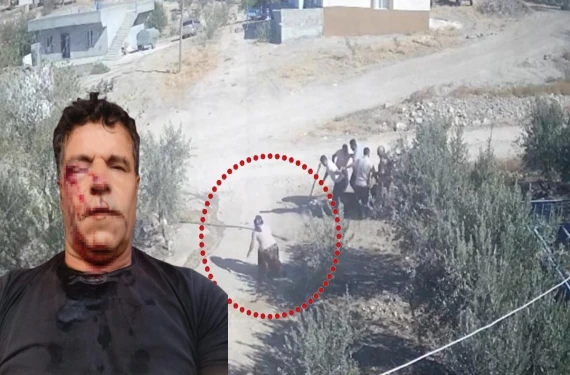 İşte eşini böyle kurtardı