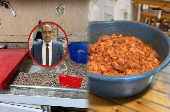 “O ciğer saplama mekanını kontrol edin!