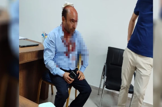 Saldırıya tepki