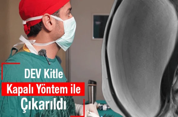 Şanlıurfa'da ameliyatla yok edildi