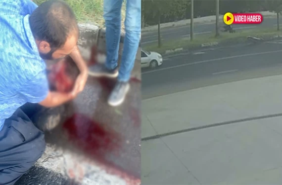 Motosikletli sürücü ağır yaralandı