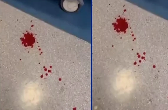 Şanlıurfa'da sağlıkçıya şiddette şok gerekçe!