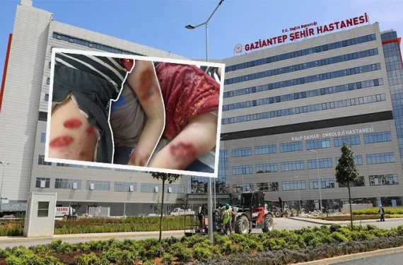 Şanlıurfa’da köpekler dehşeti yaşatmıştı!