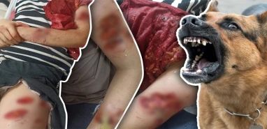 Şanlıurfa'da başıboş köpek dehşeti!