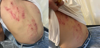 Şanlıurfa'da kamera kaydı olsa yer yerinden oynar! Belediye personeline köpekli saldırı