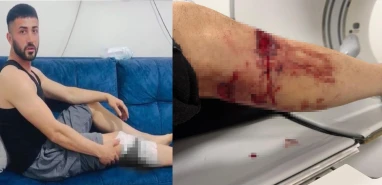 Başıboş köpekler dehşet saçtı: 2 kişi yaralandı