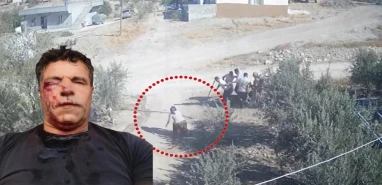 Şanlıurfa'da herkes bu kadını konuşuyor: İşte eşini böyle kurtardı