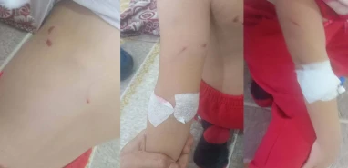 Şanlıurfa'da sokak köpeği dehşeti! 6 yaşındaki kız...