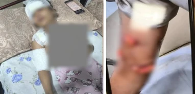 Şanlıurfa'da çocuğa başıboş sokak köpekleri saldırdı iddiası!