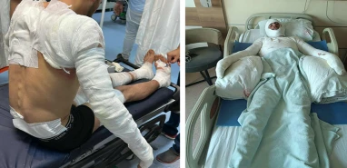 Şanlıurfa'da tarla yangını! 1'i ağır 5 yaralı