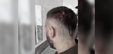 Şanlıurfa'da öğretmene veliden şiddet! Öğretmenden üzen karar