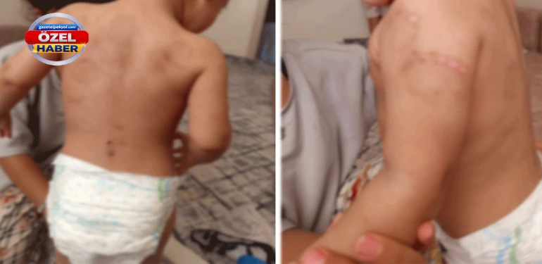Şanlıurfa'daki yetkililerden vahim bahane! Çocuklara işkence kan donduruyor