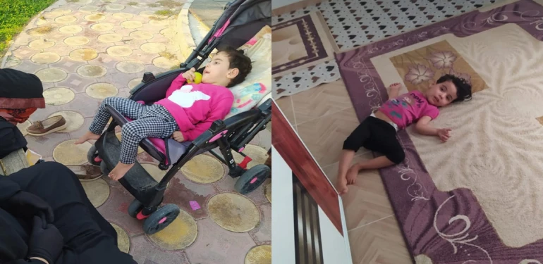 Şanlıurfa’da iki kardeşin hayatı doğru tedaviyle baştan yazıldı