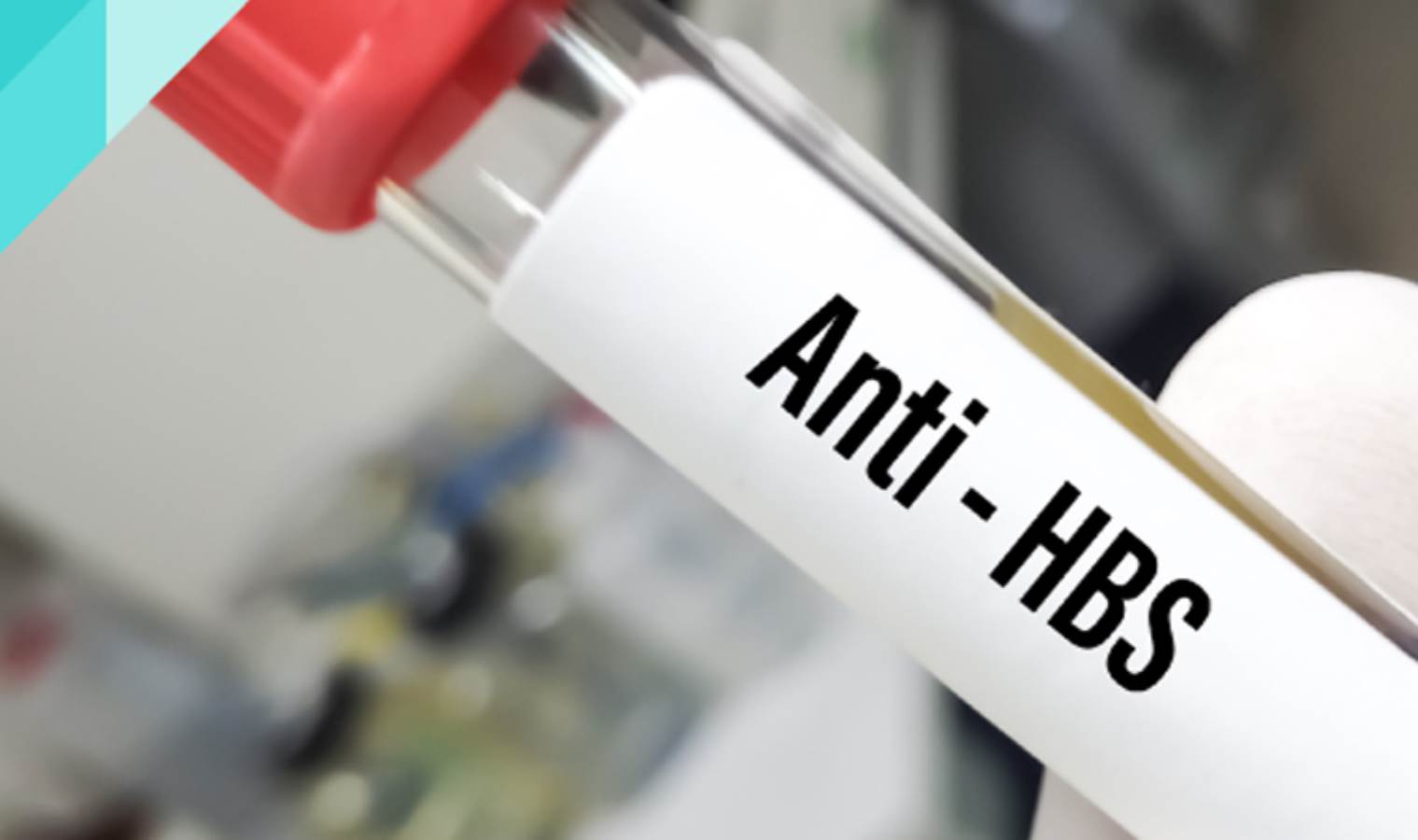 Anti HBS pozitif ne demek?