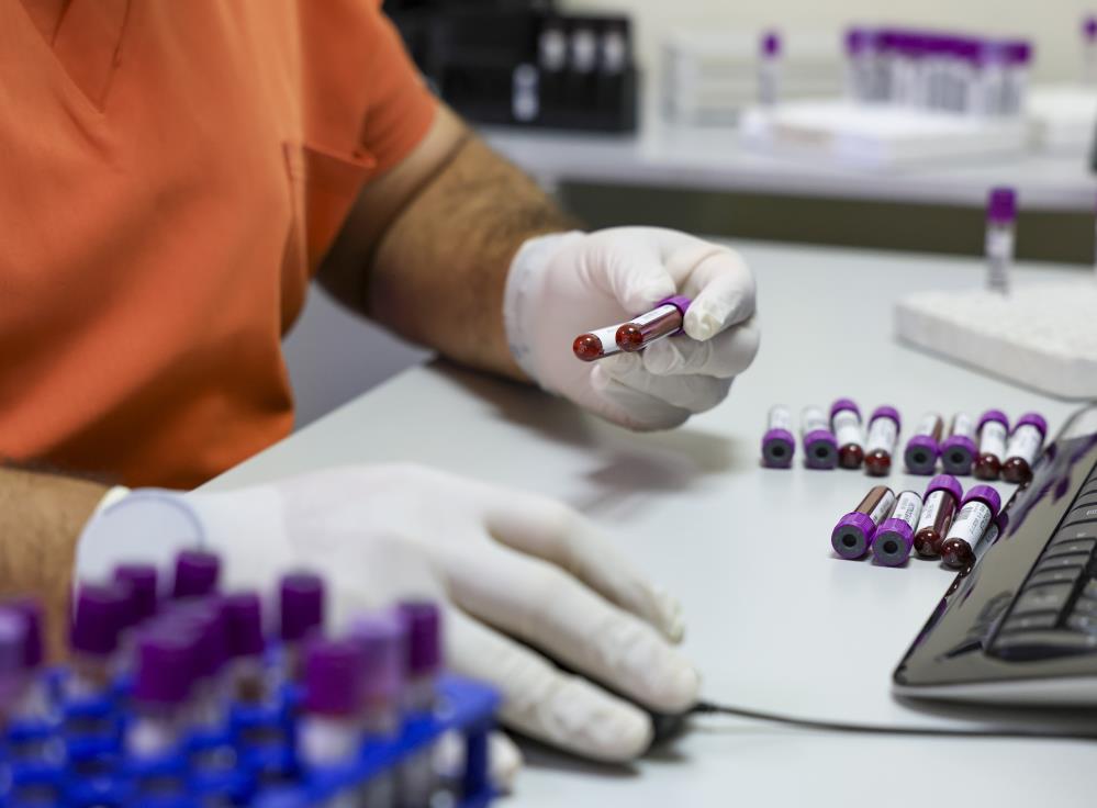 Şanlıurfa'ya 2 binden fazla sözleşmeli personel alınacak! İşte branş dağılımı