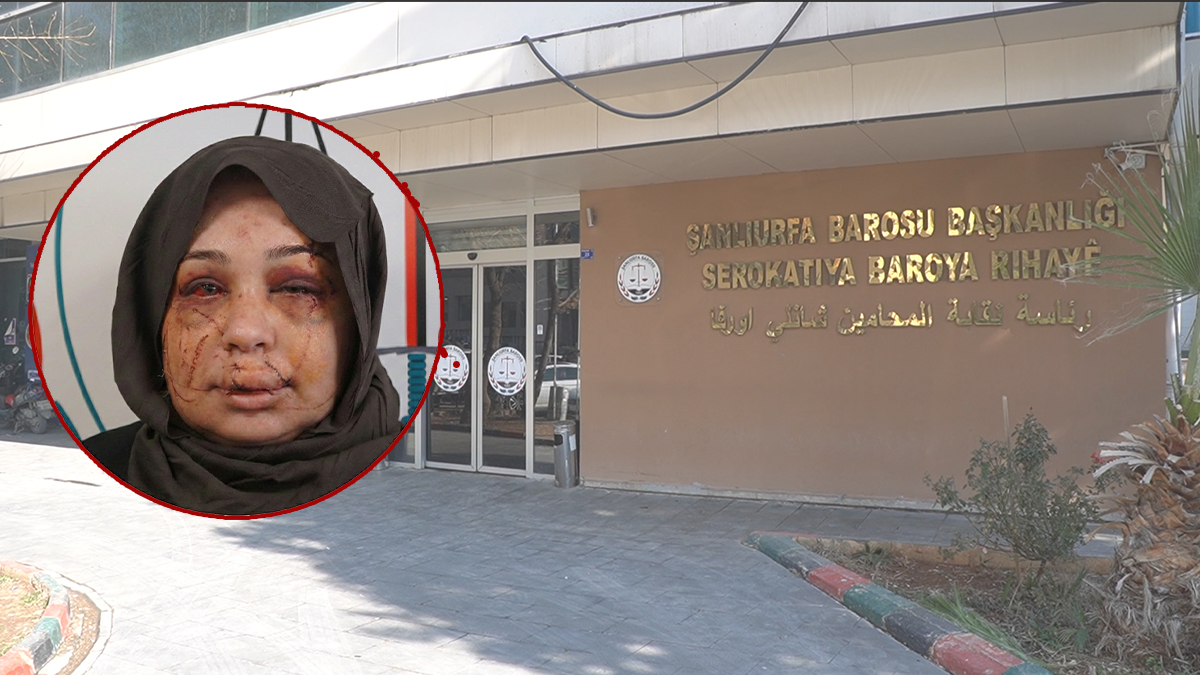 Şanlıurfalı eşine şiddet uygulayan kocanın ifadesi ortaya çıktı! “Şiddete ben maruz kaldım”