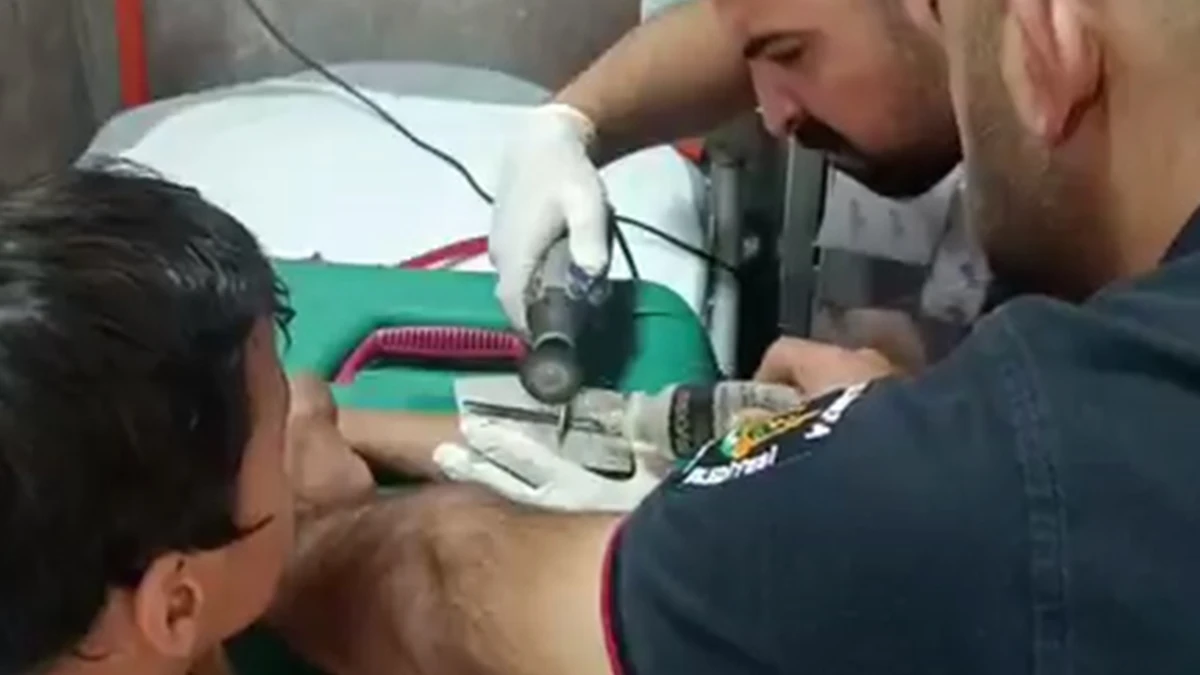 Şanlıurfa’da korku dolu anlar: Küçük çocuğun parmağına rondela sıkıştı!