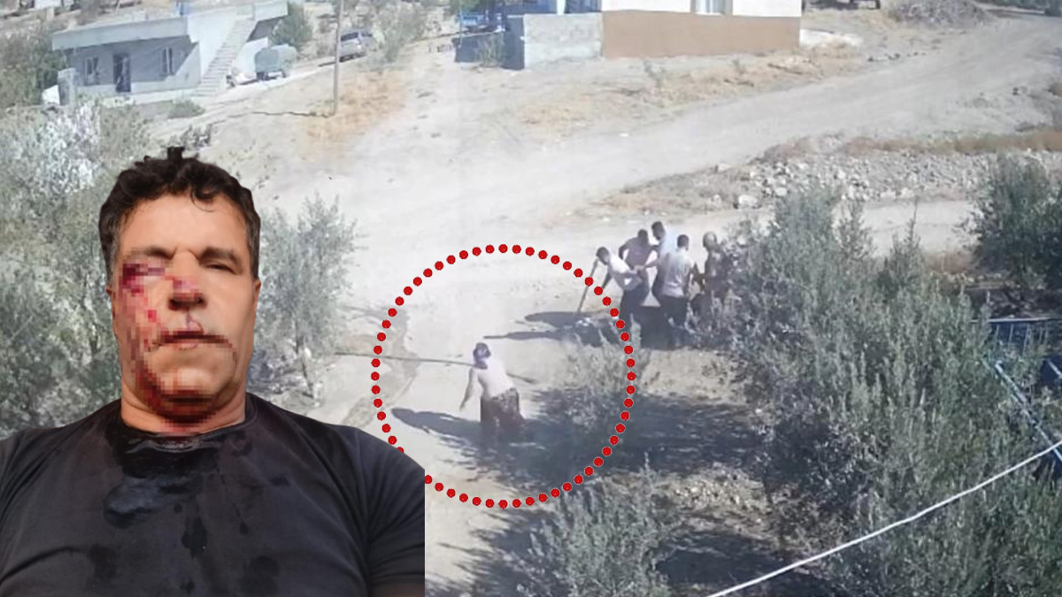 Şanlıurfa'da herkes bu kadını konuşuyor: İşte eşini böyle kurtardı