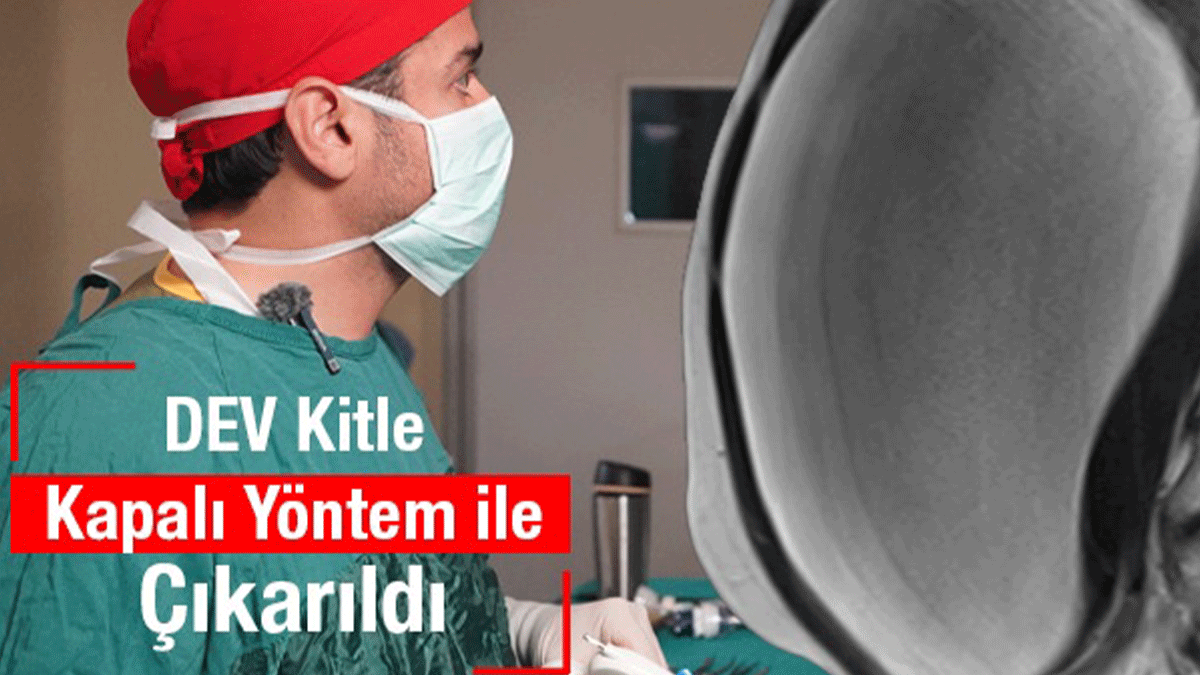 Kasık ve göğüs arası uzanan dev kitle! Şanlıurfa'da ameliyatla yok edildi