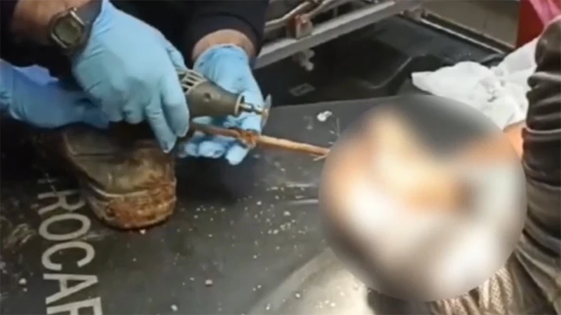 Şanlıurfa’da inşaatta iş kazası: Ayağına demir saplandı