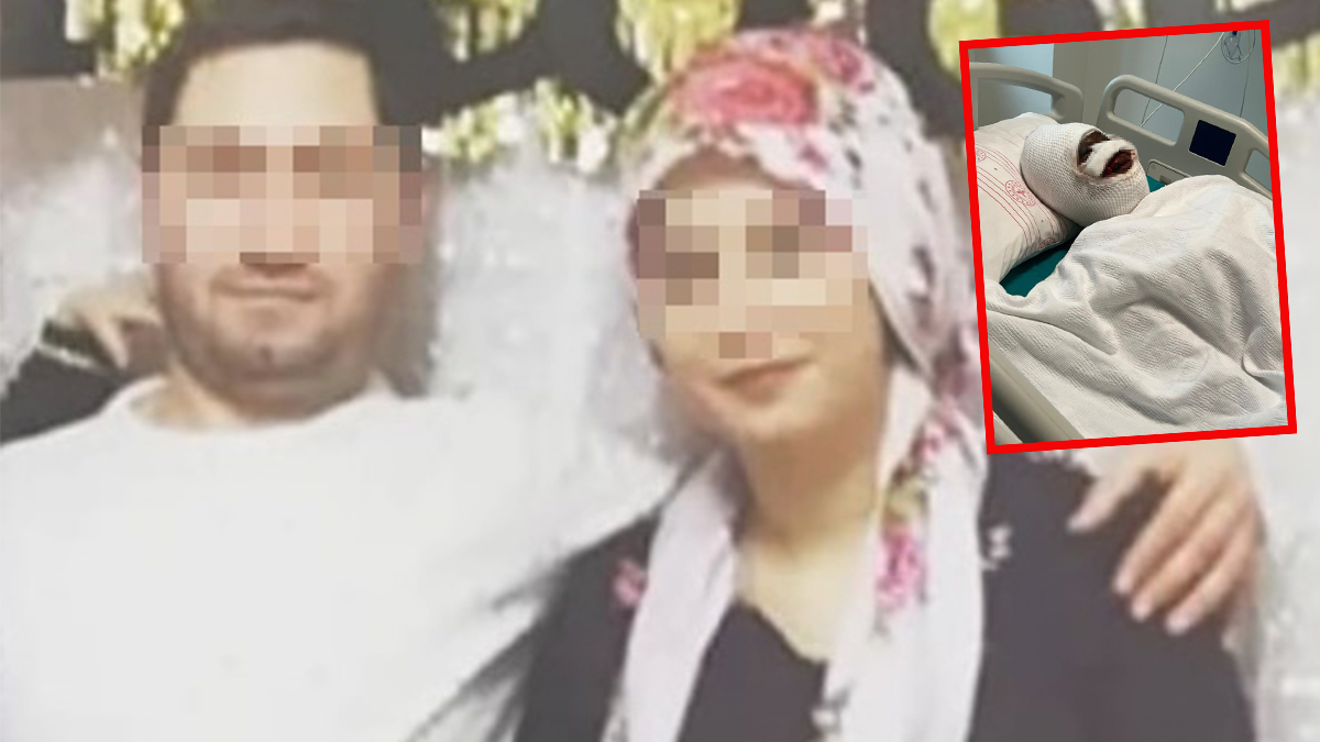 Gaziantep'te eski eş dehşeti! Başından aşağı kezzap döktü