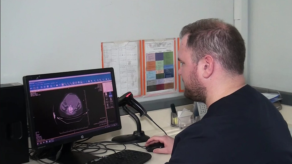 Şanlıurfa'da doktorları bile şaşırtan vaka: Karnında dev bir kitleyle yaşıyormuş!