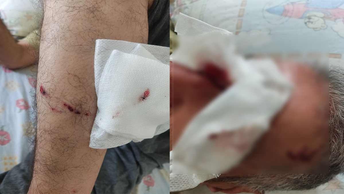 Şanlıurfa’da kentin göbeğinde başıboş köpek dehşeti: 2 yaralı!