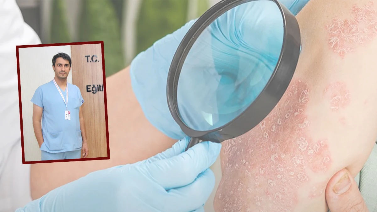 Şanlıurfa’da cildinde bu belirtiler olanlar dikkat!