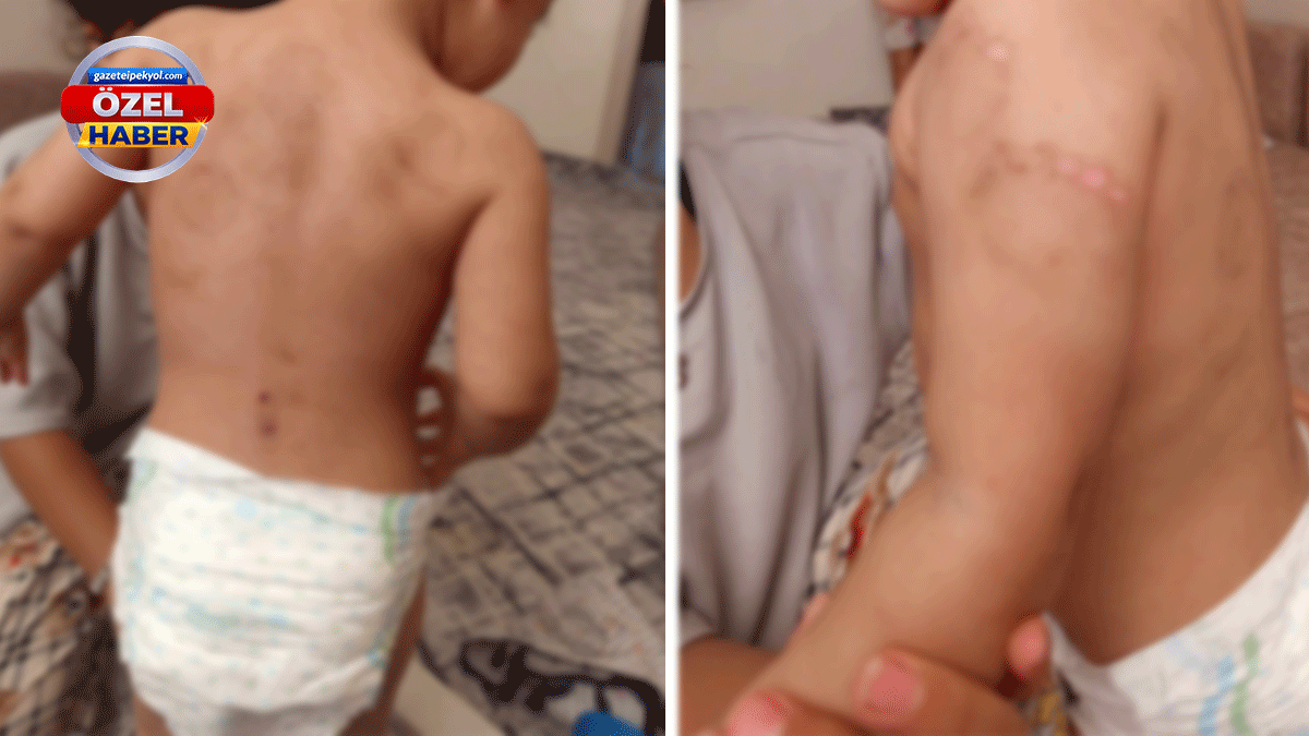Şanlıurfa'daki yetkililerden vahim bahane! Çocuklara işkence kan donduruyor