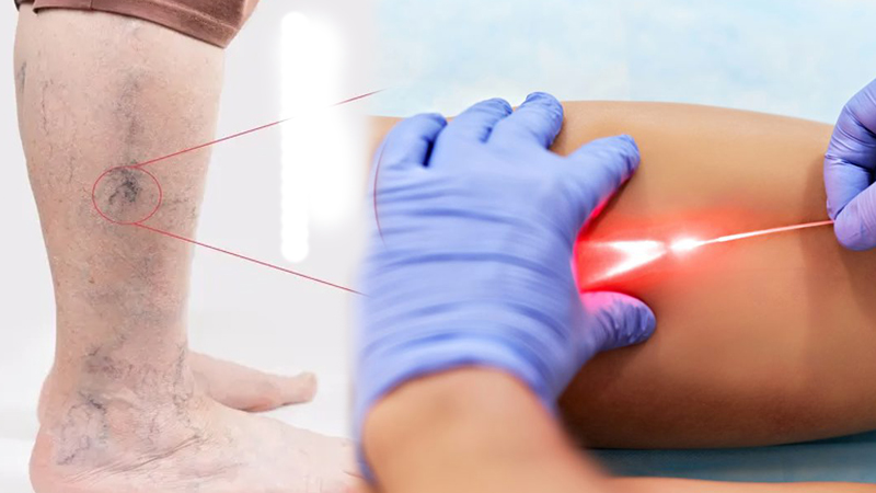 Şanlıurfa’da ciddi sağlık sorununa hızlı tedavi yöntemi!