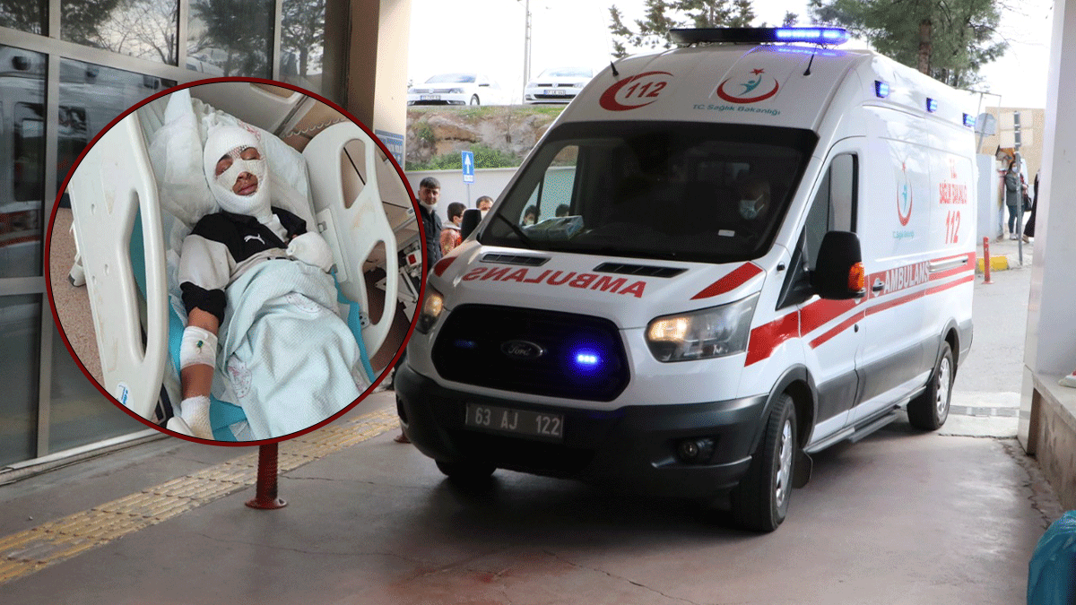 Şanlıurfa’da tinerle ısınmak isteyen genç ağır yaralandı!
