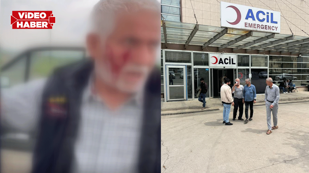 Şanlıurfa’da yaşlı adama köpek saldırdı! Yoldan geçen tur otobüsü fark edip kurtardı