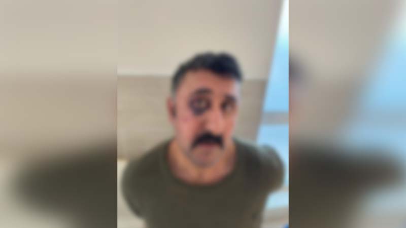 Şanlıurfa’da avukata darp iddiası! Baro suç duyurusunda bulunacak