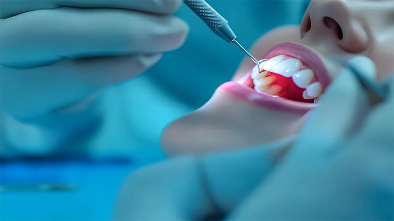 Şanlıurfa’da da diş hekimleri iş bıraktı!