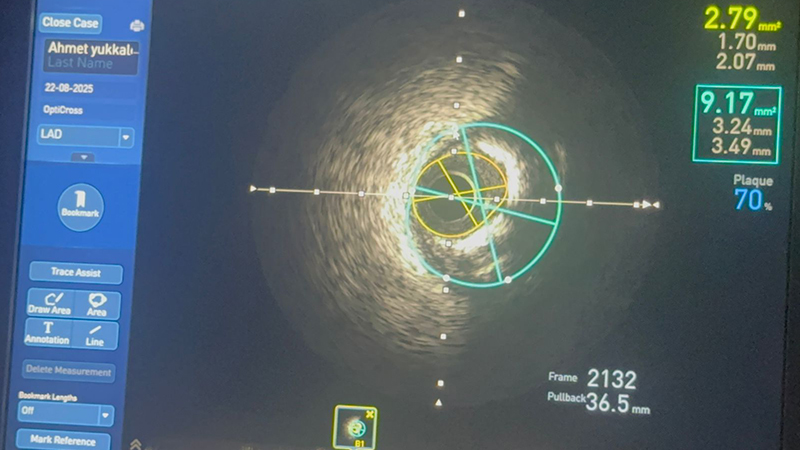 Şanlıurfa’da sağlıkta bir ilk!
