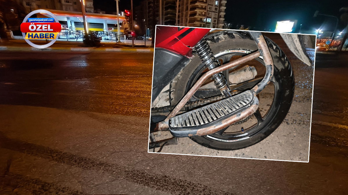 Şanlıurfa’da sakat kalmanın eşiğinden döndü! Acısını unuttu, faciayı önledi
