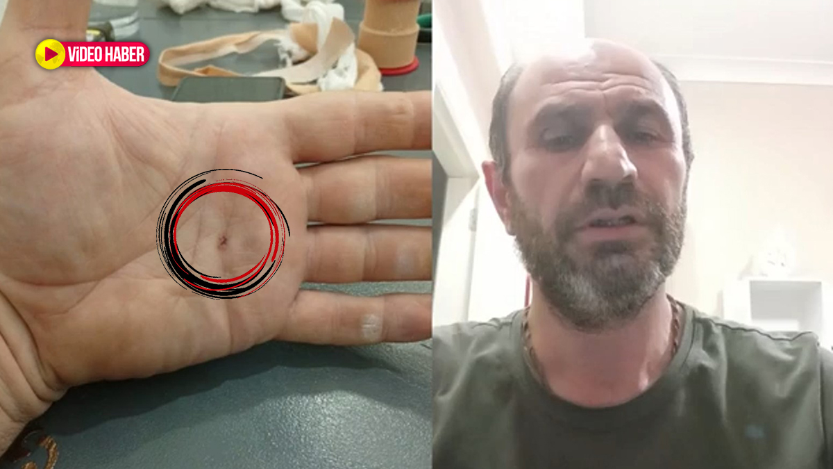 Şanlıurfa’da tedavi yerine özel hastaneye yönlendirme iddiası!