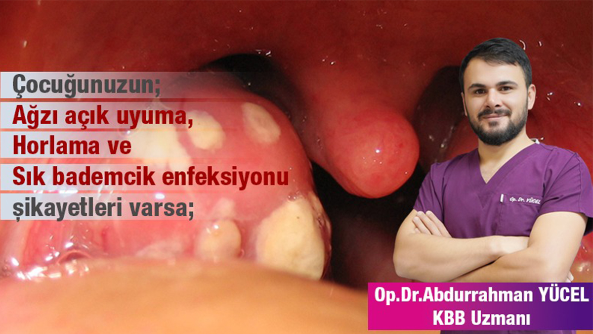 Şanlıurfa’da KBB uzmanı tehlikeye karşı uyardı: Çocukların büyümesini sessizce durduruyor