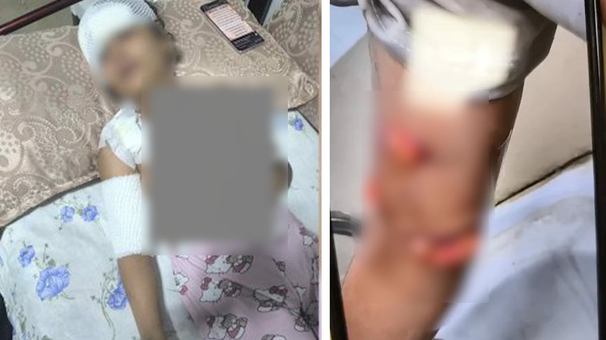 Şanlıurfa'da çocuğa başıboş sokak köpekleri saldırdı iddiası!