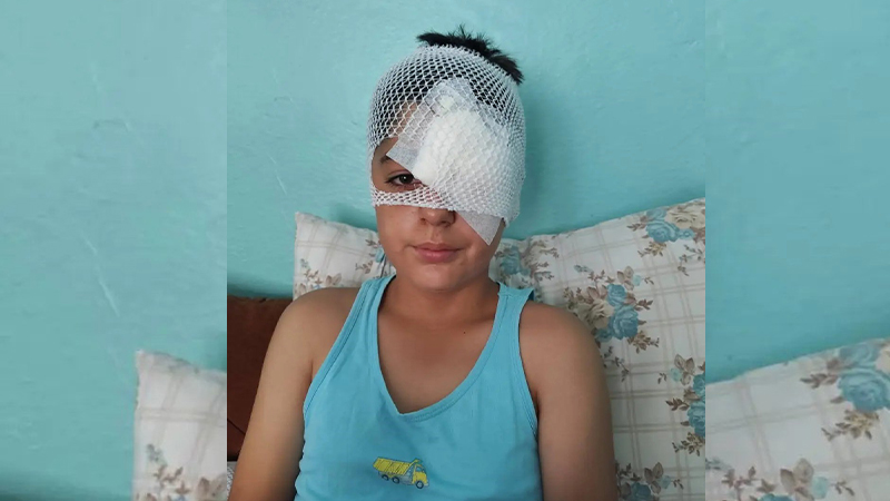 Şanlıurfa’da köpekten kaçan çocuğa otomobil çarptı