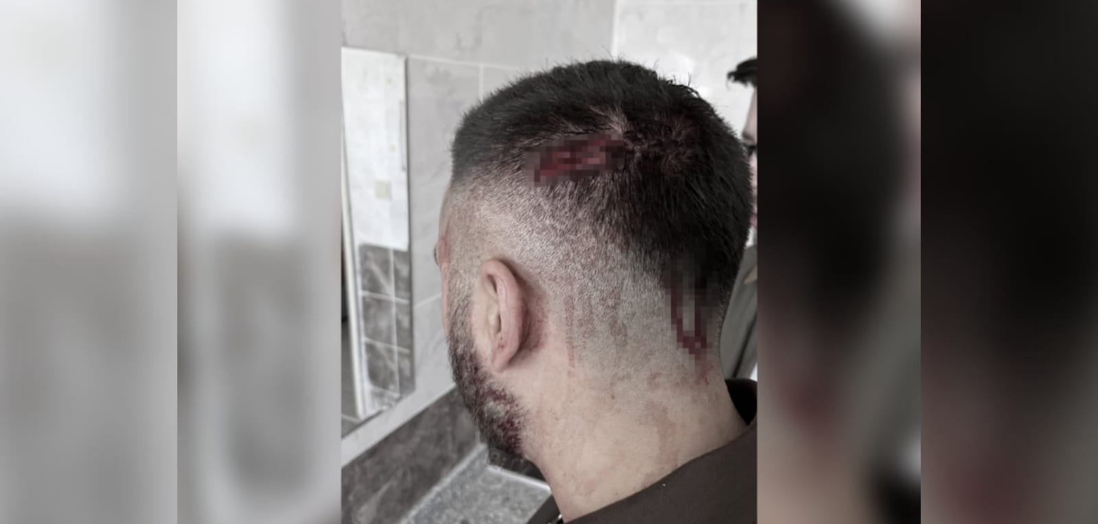 Şanlıurfa'da öğretmene veliden şiddet! Öğretmenden üzen karar